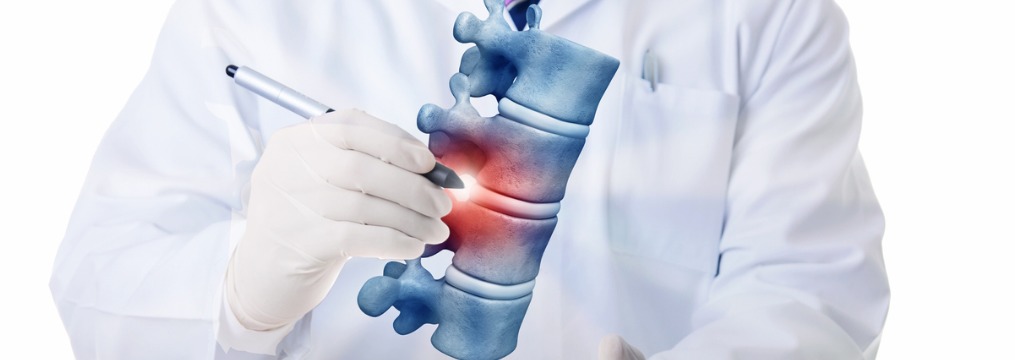 Very high resolution 3d rendering of four human vertebae.